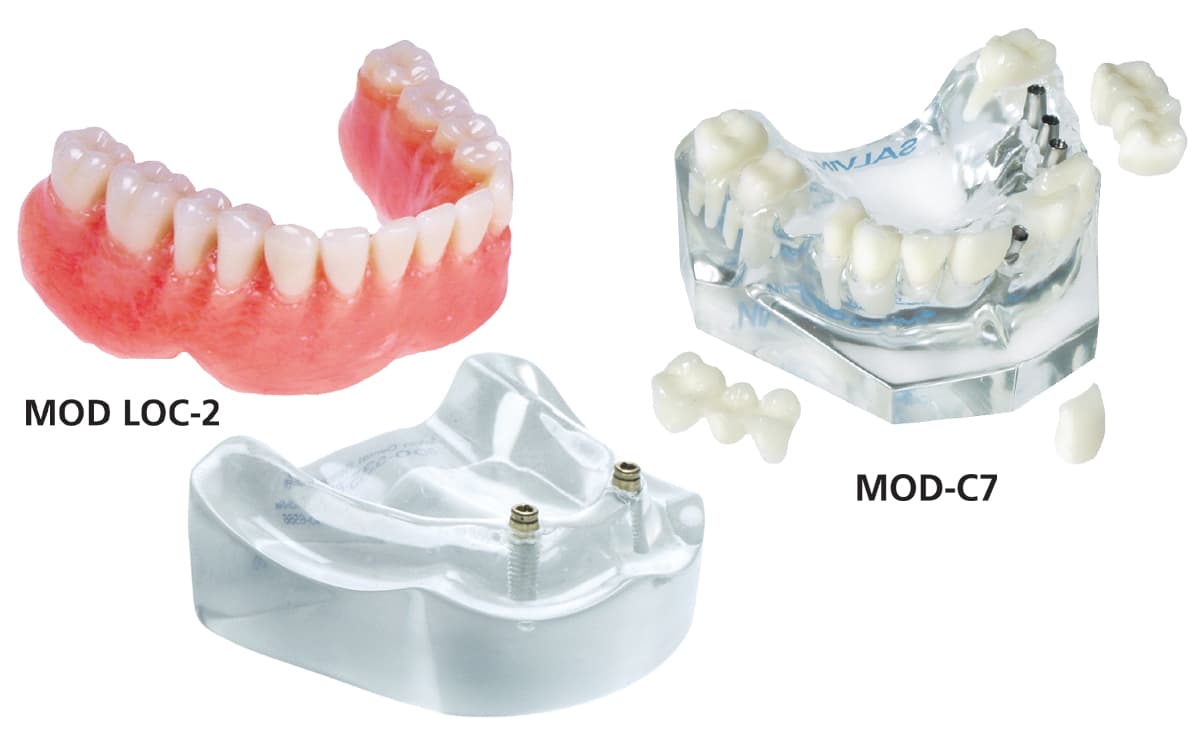 Locator™ Model + Crown & Bridge Model